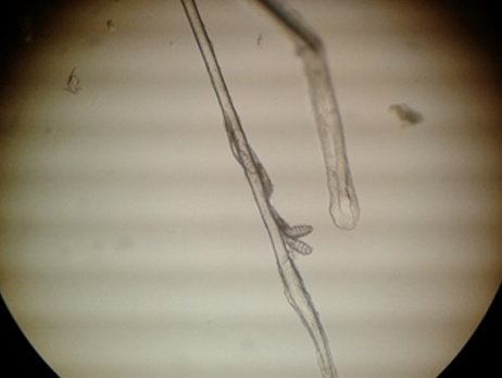 Клещи Demodex canis